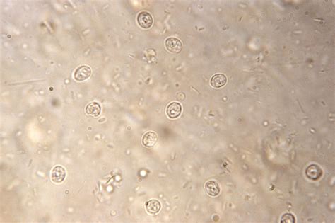  Cryptosporidium - A Microscopic Marvel That Can Make You Very Uncomfortable Indeed!