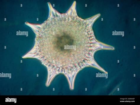  Giant Ciliate! A Glimpse into the Microscopic World of These Hairy Single-Celled Creatures